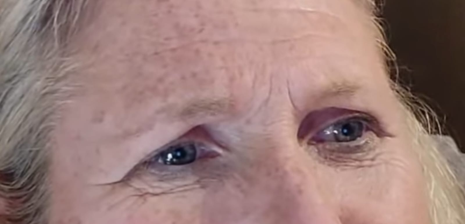 Before treatment