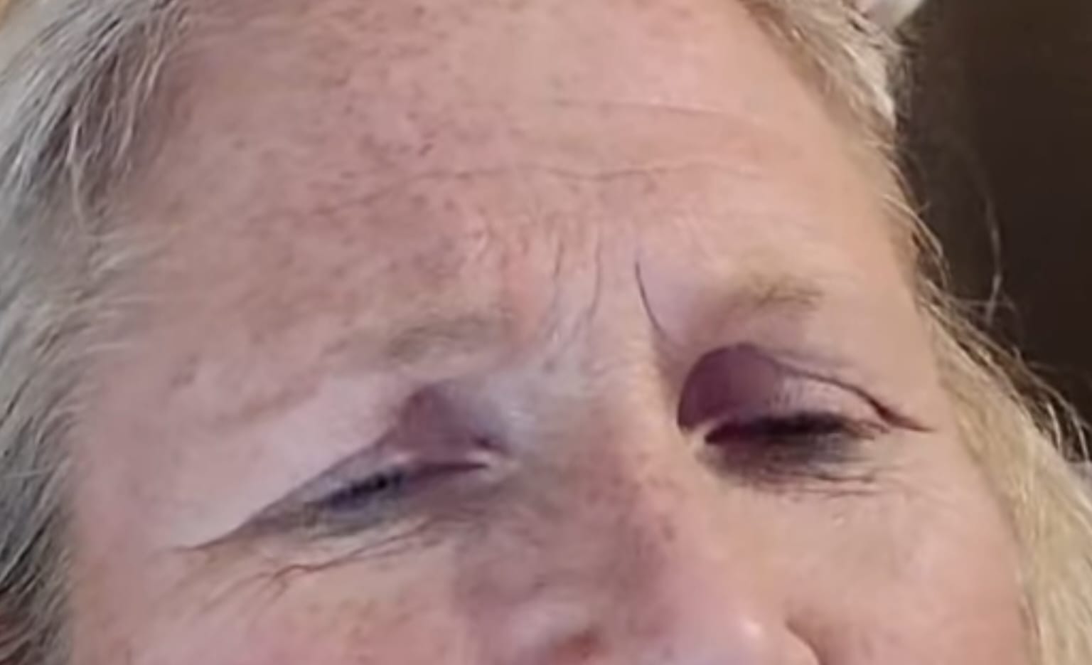 Before treatment