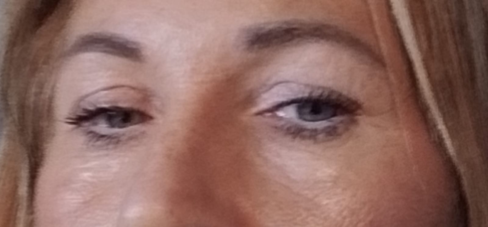 After treatment