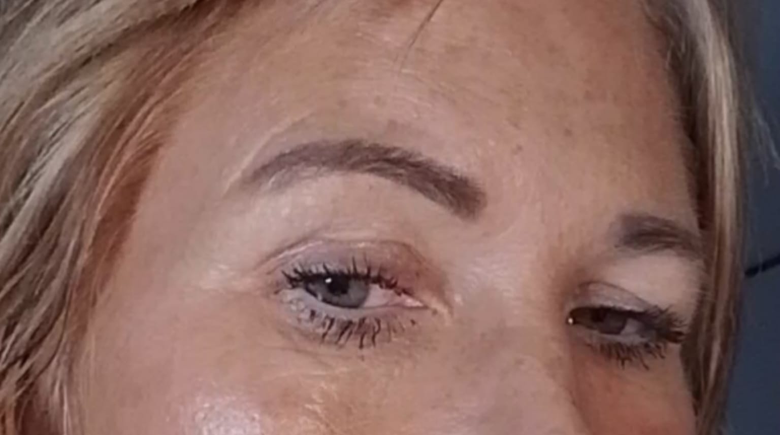 After treatment
